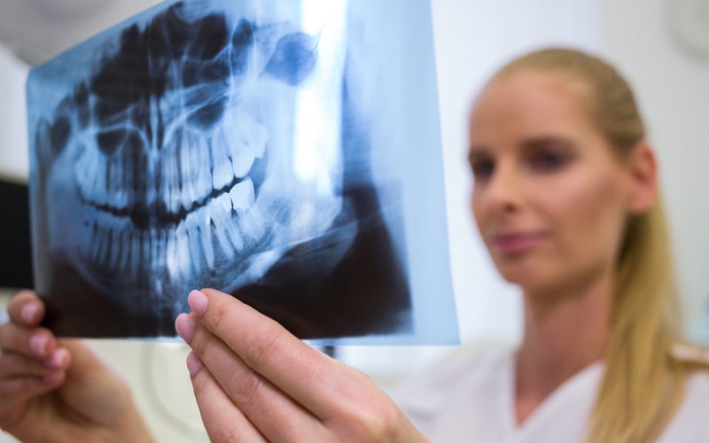 dentystka analizuje badanie rentgenowskie