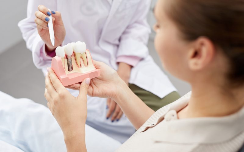 model implantacji zęba